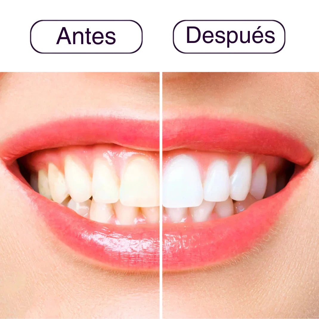 Suero Blanqueador Claréa 30ml (LLEVA 2X1)